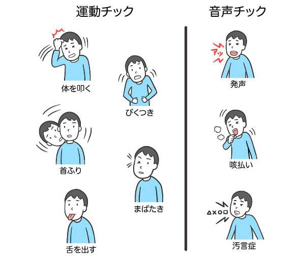 記事サムネイル