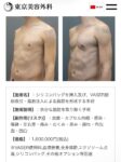 レス2番の画像2